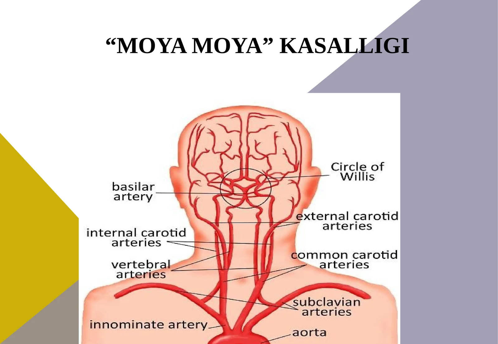 Moyamoya kasalligi