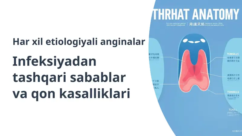 Angina: Infeksiyadan Tashqari Sabablar va Qon Kasalliklari