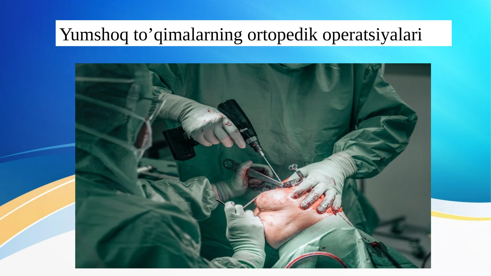 Yumshoq to’qimalarning ortopedik operatsiyalari