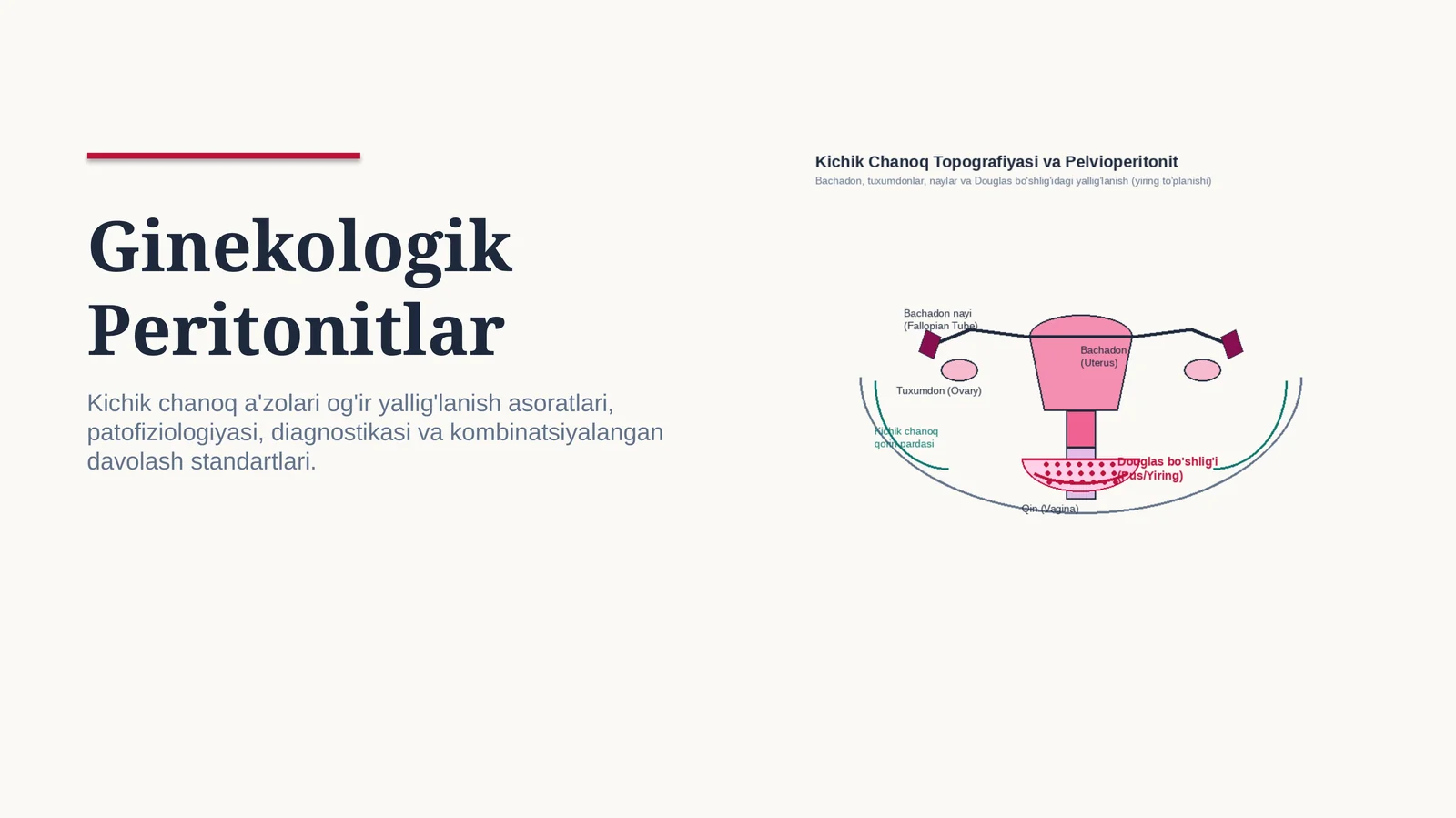 Ginekologik peritonitlar — 15 slaydli professional tibbiy taqdimot | Ginekologiya va akusherlik