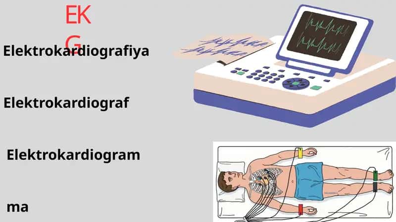 EKG