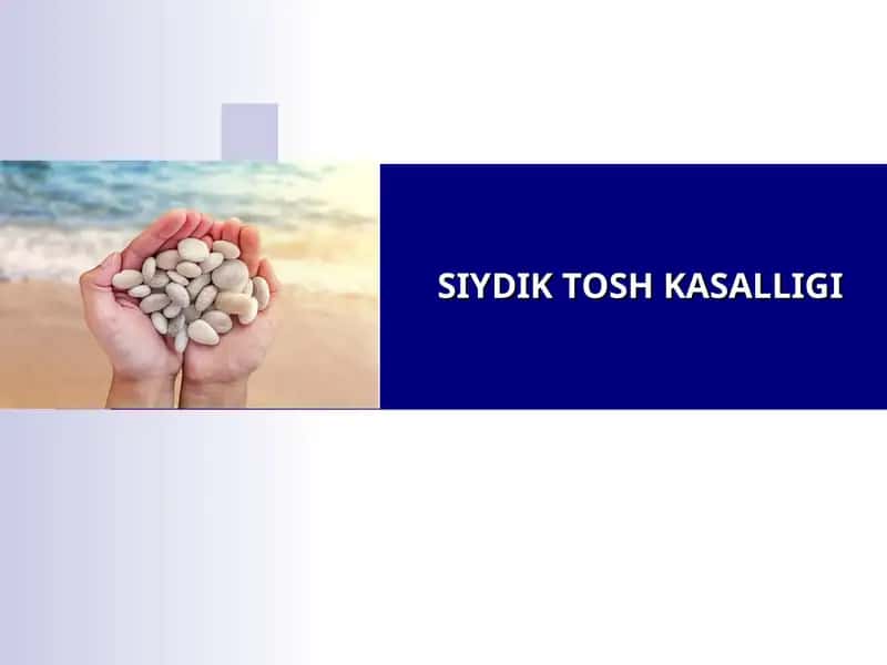 SIYDIK TOSH KASALLIGI