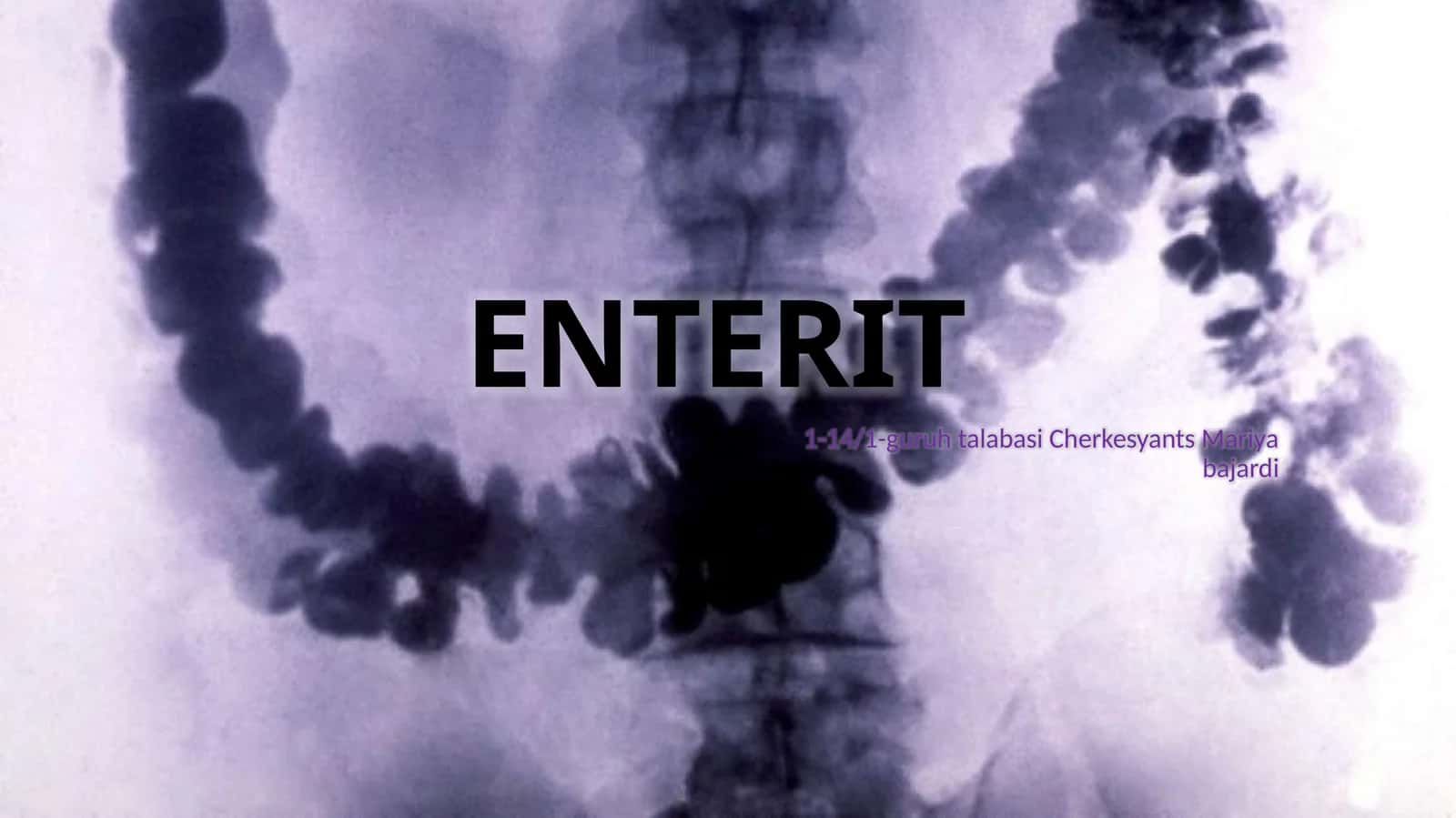 Enterit ingichka ichak yallig'lanishi (2-variant)
