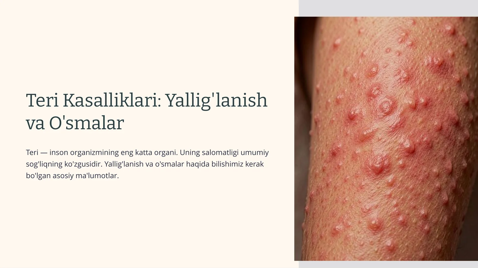 Teri Kasalliklari: Yallig'lanish va O'smalar