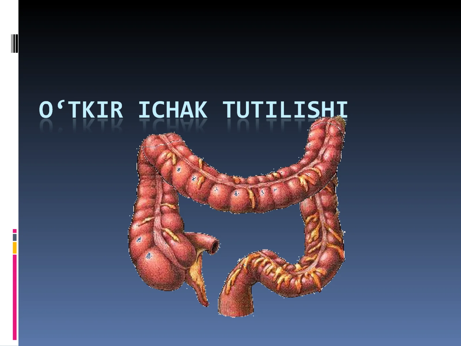 Ichak tutilishi