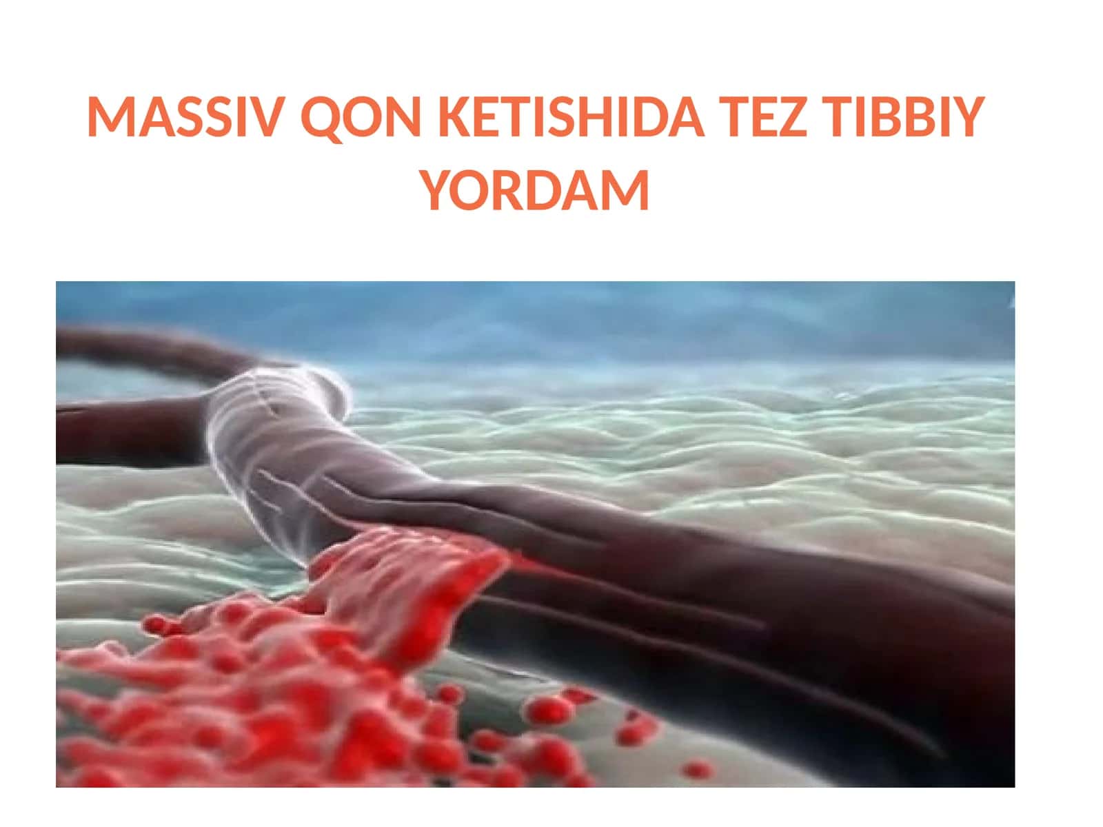 MASSIV QON KETISHIDA TEZ TIBBIY YORDAM