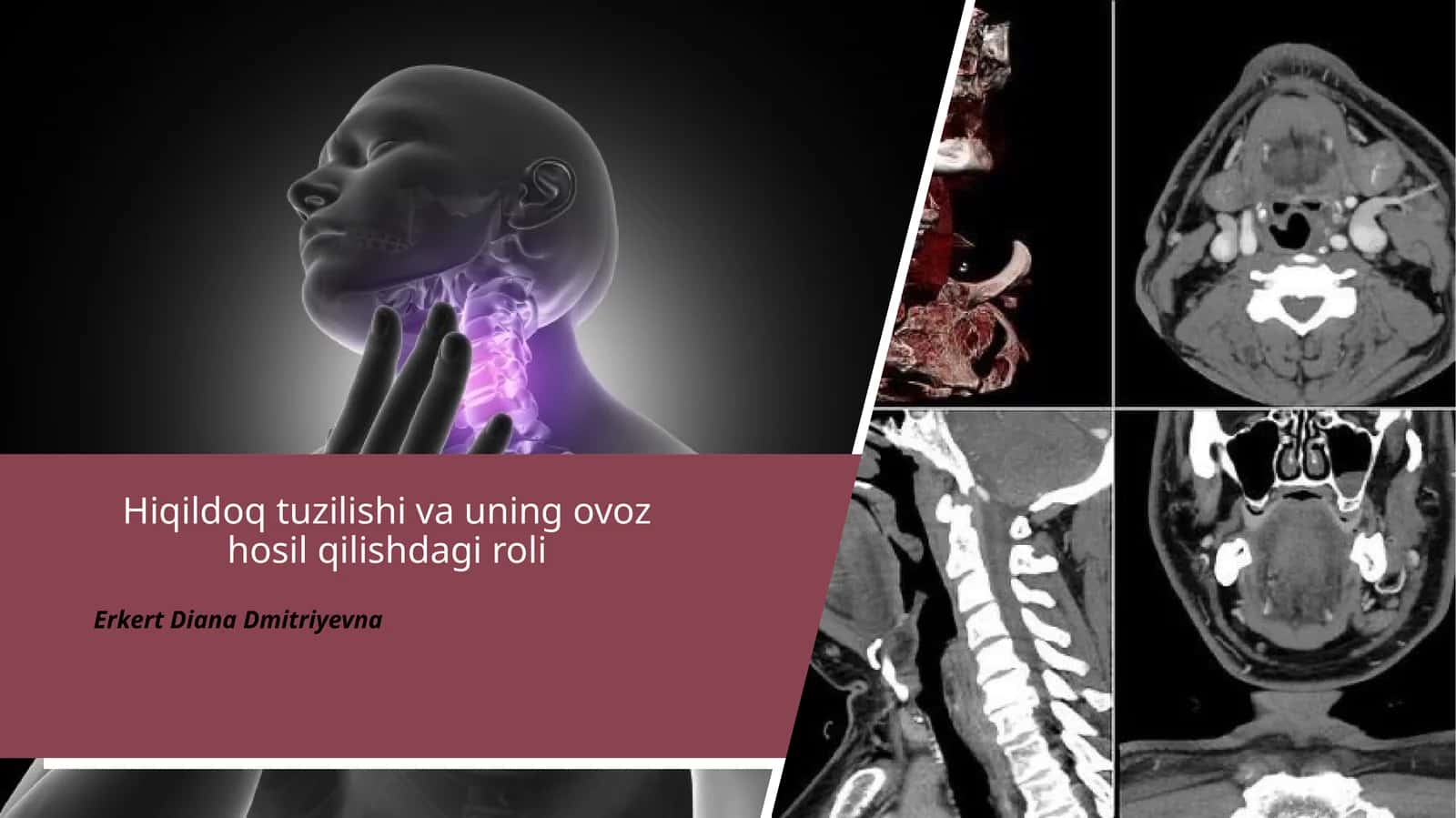 Hiqildoq tuzilishi va ovoz hosil qilish (1-qism)