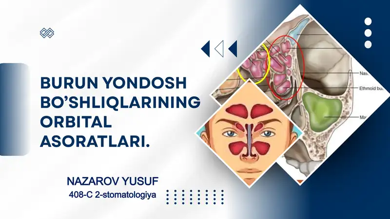 BURUN YONDOSH BO’SHLIQLARINING ORBITAL ASORATLARI