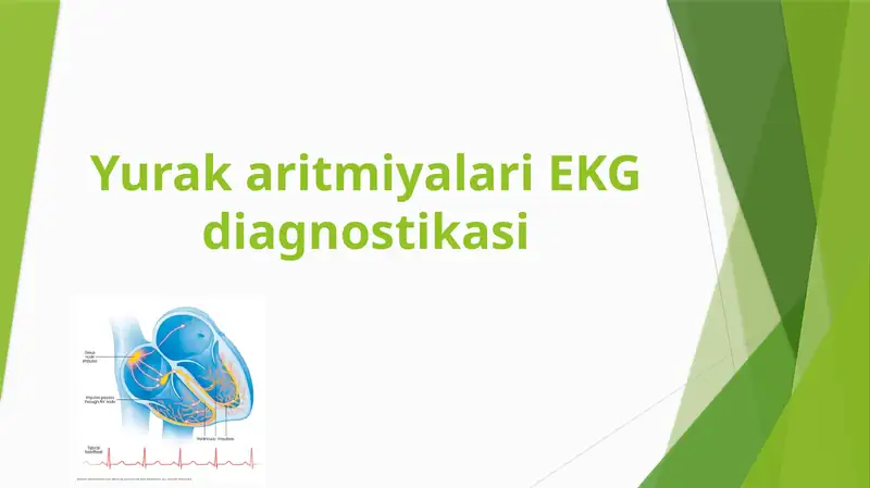 Yurak aritmiyalari EKG diagnostikasi