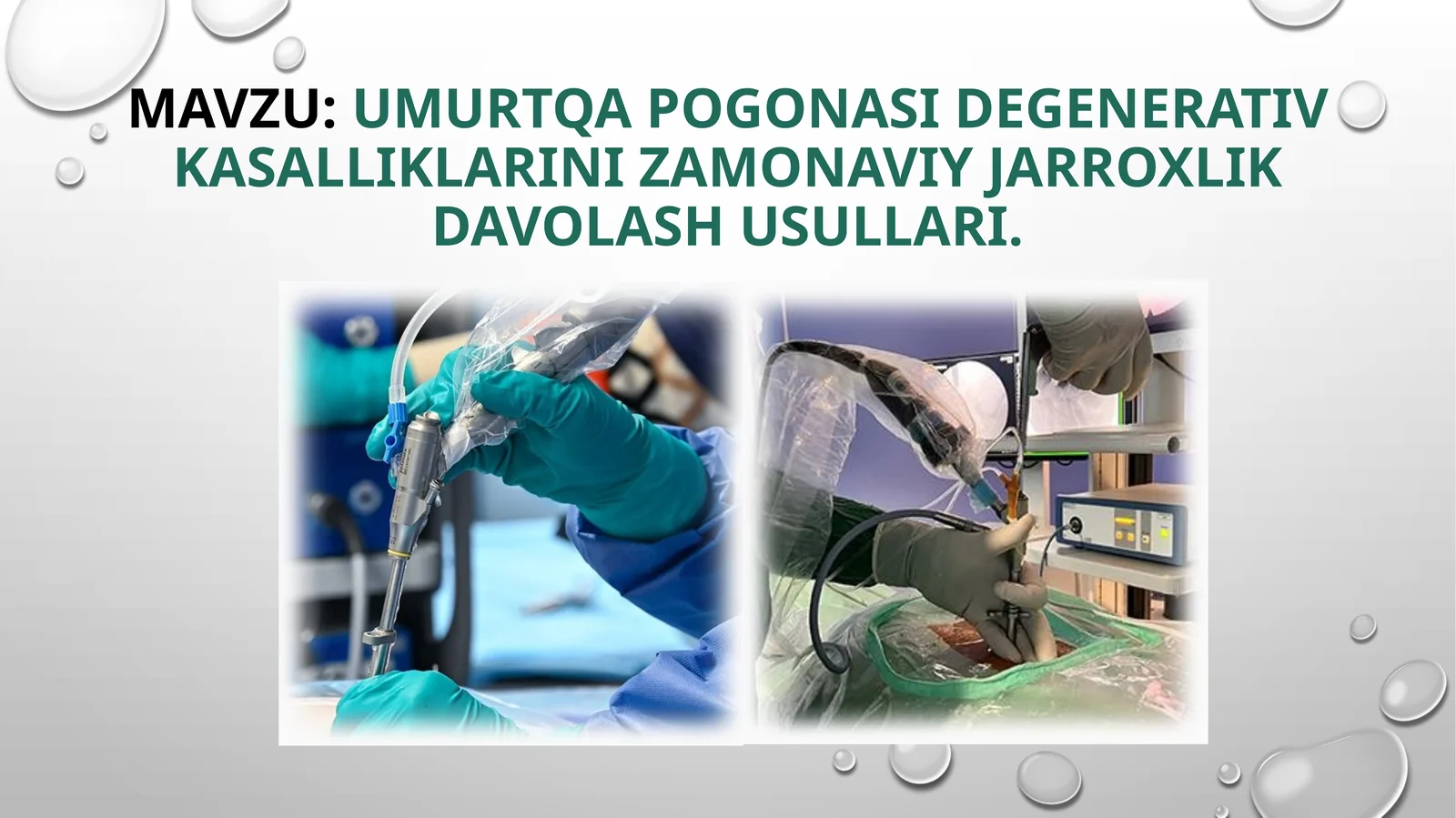 Umurtqapogonasidegenerativkasalliklarini zamonaviyjarroxlikdavolash usullari