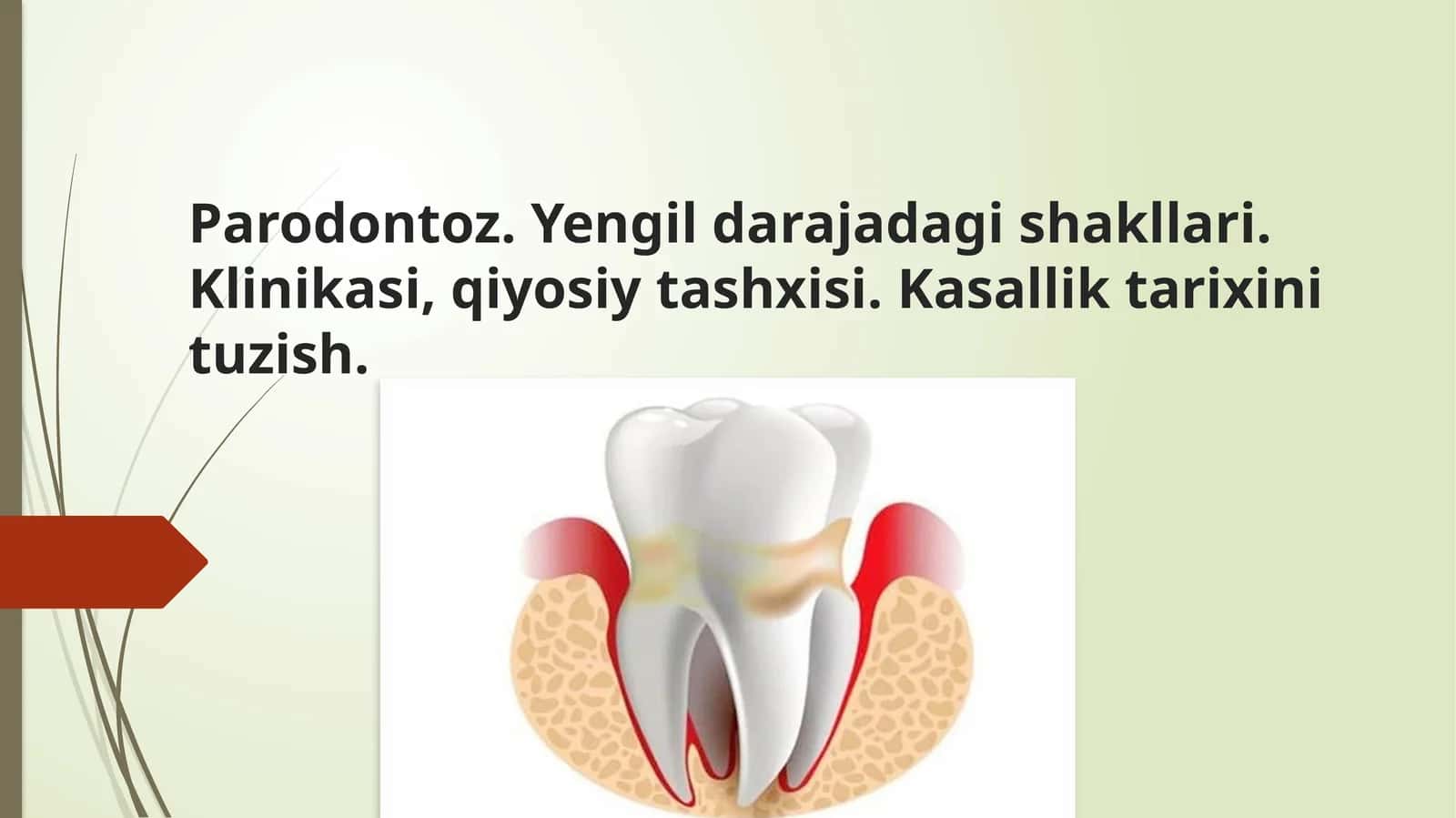 Parodontoz. Yengil darajadagi shakllari. Klinikasi, qiyosiy tashxisi. Kasallik tarixini tuzish