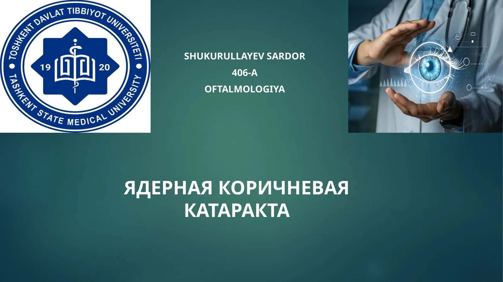 Ядроли катаракта