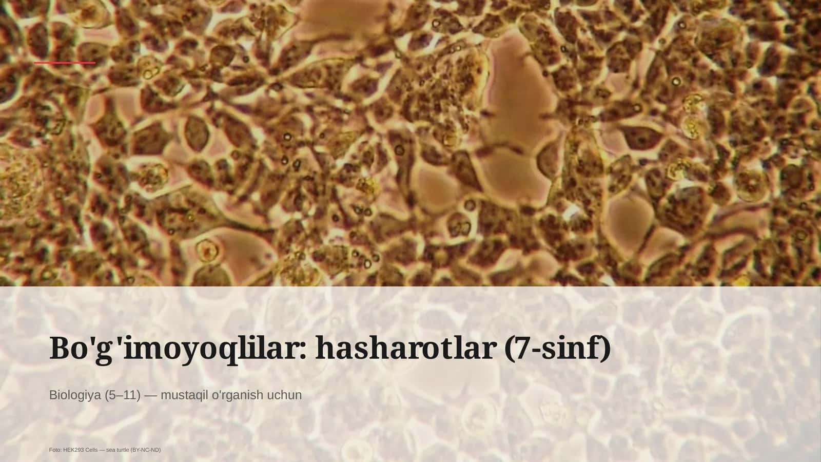 Bo'g'imoyoqlilar: hasharotlar (7-sinf)