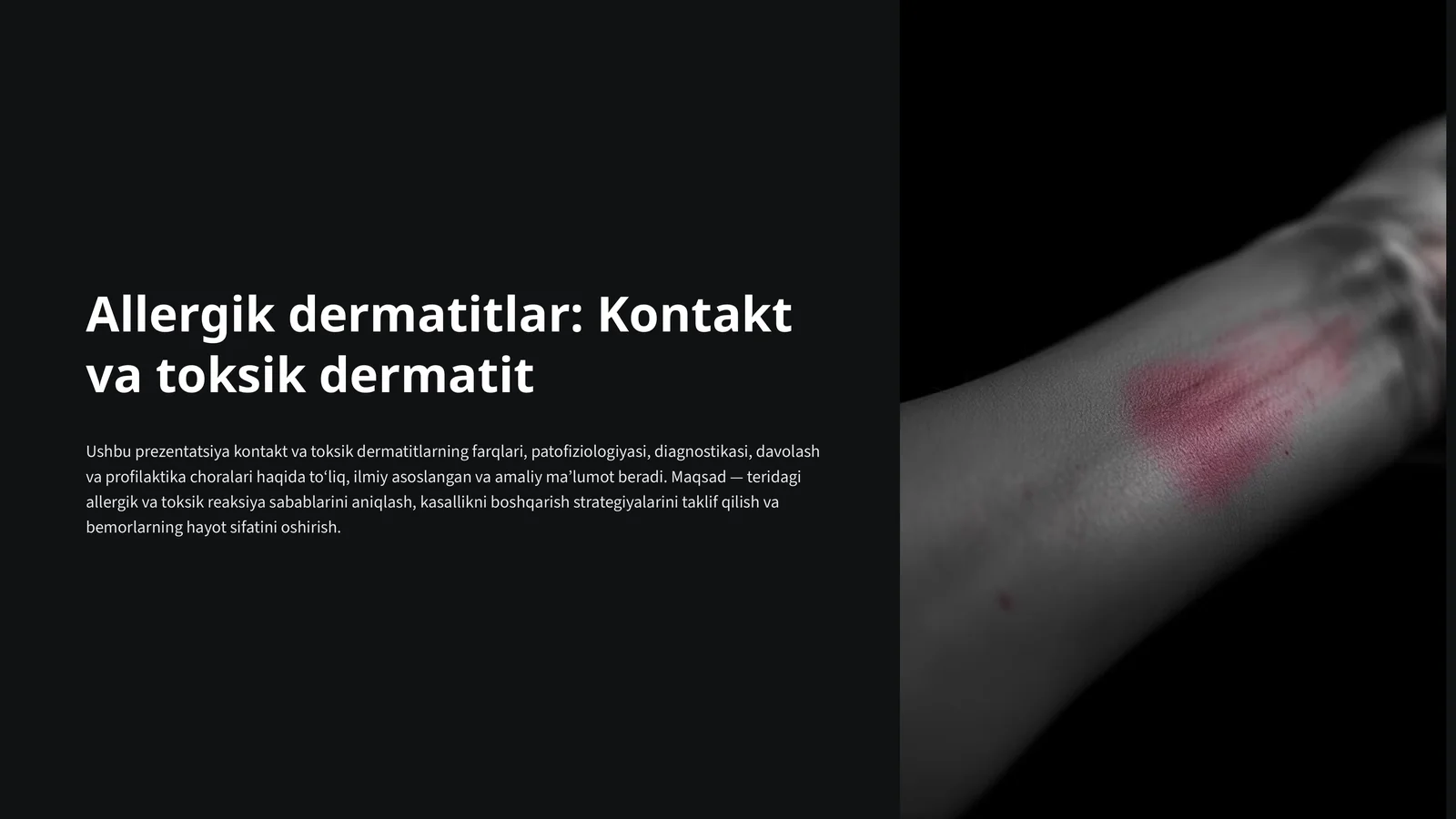 Allergik dermatitlar: Kontakt va toksik dermatit