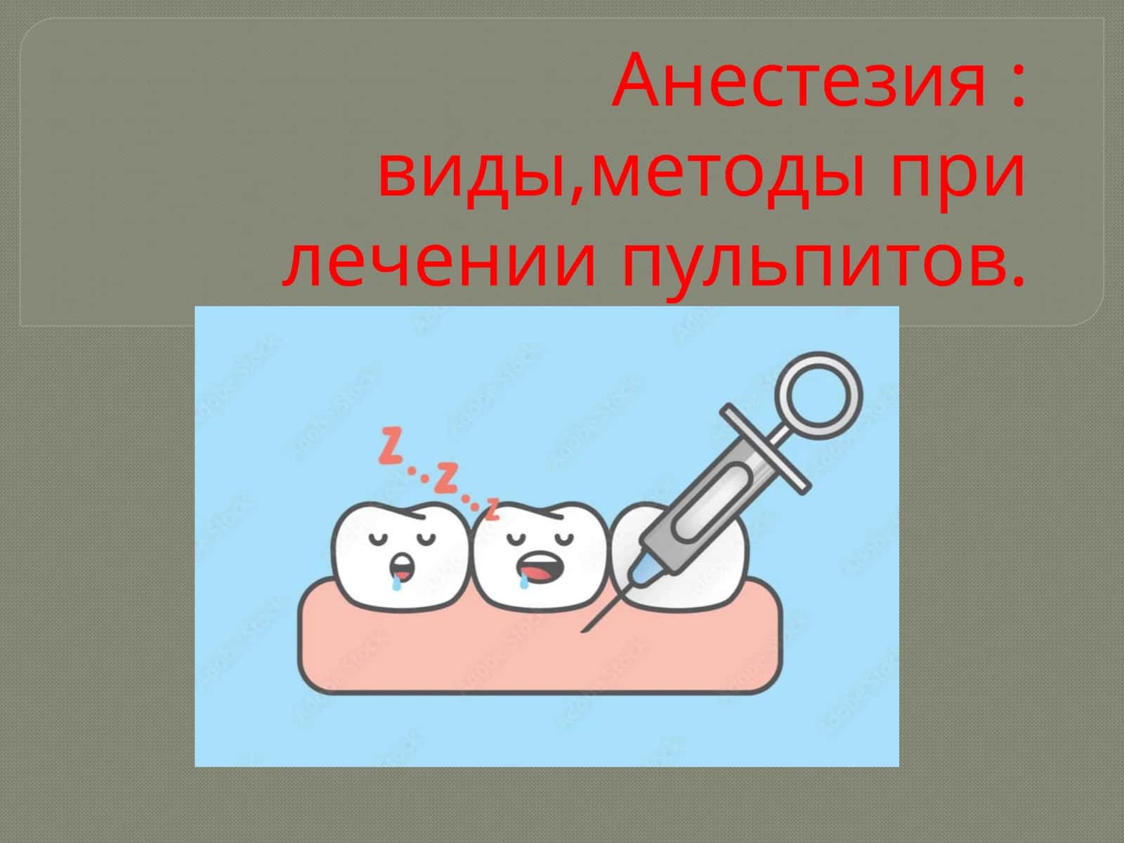 Анестезия: виды, методы при лечении пульпитов