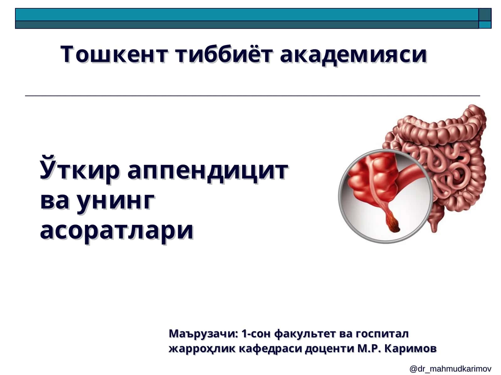 Ўткир аппендицит ва унинг асоратлари