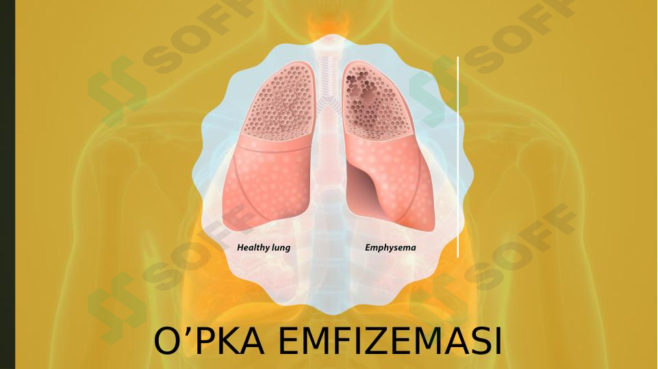 O'PKA EMFIZEMASI