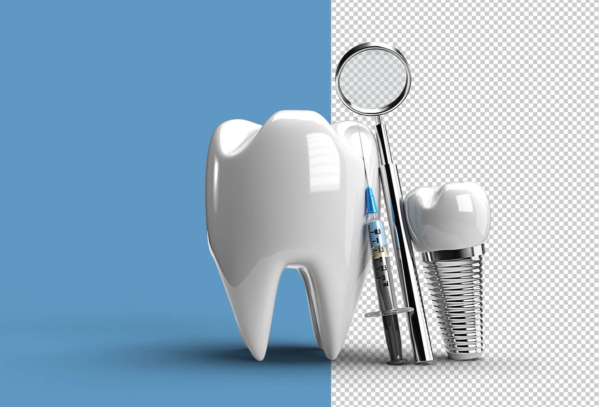 Tish implantlari jarrohlik kontseptsiyasi 3D ko'rsatuvchi shaffof PSD fayli | Dental implants surgery concept 3d rendering transparent psd file