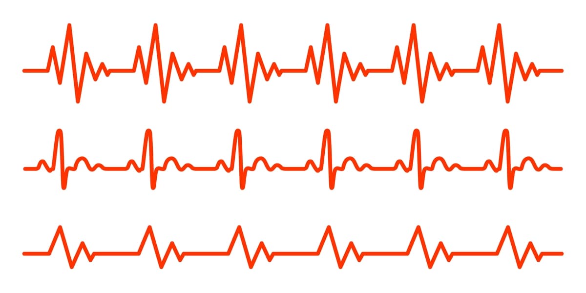 Qizil yurak urishi piktogrammalarining tekis dizayndagi vektor tasviri elektrokardiogramma belgisi | Red heartbeat icons flat design vector illustration sign electrocardiogram