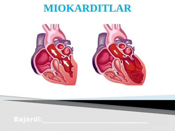 Miokarditlar