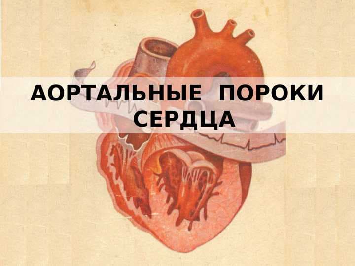 АОРТАЛЬНЫЕ  ПОРОКИ СЕРДЦА