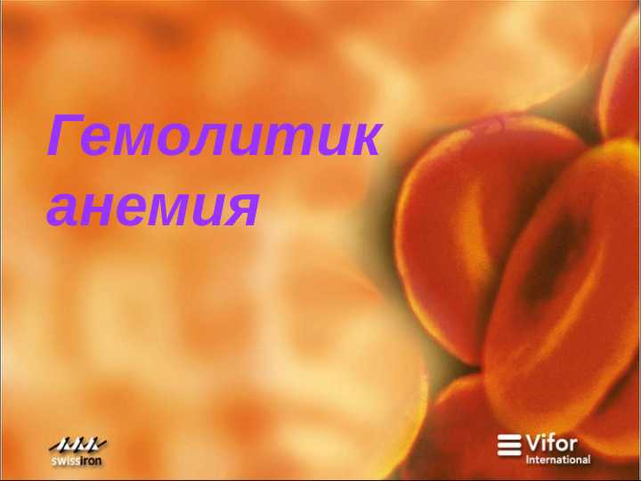 Гемолитик  анемия