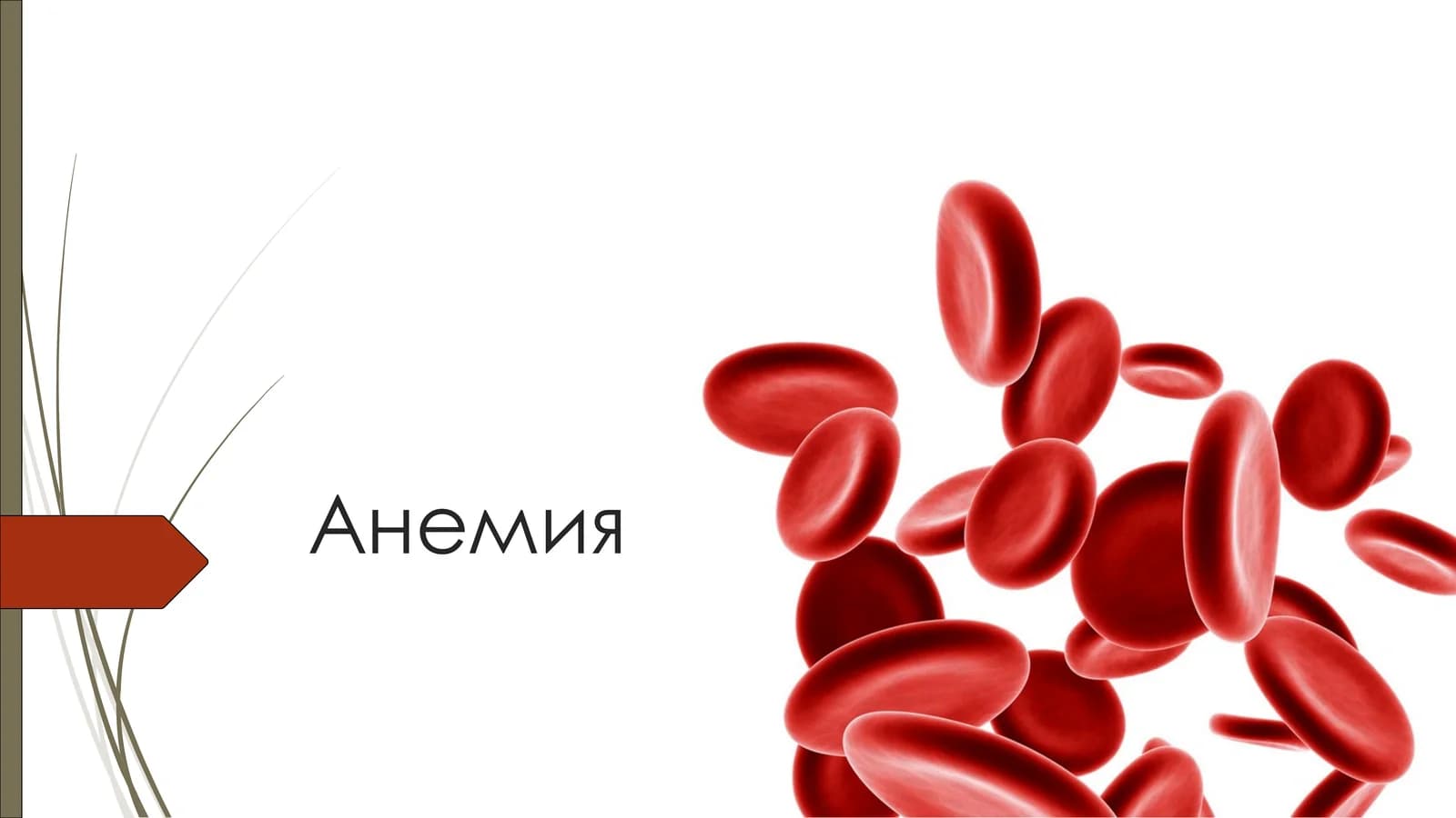 Анемия