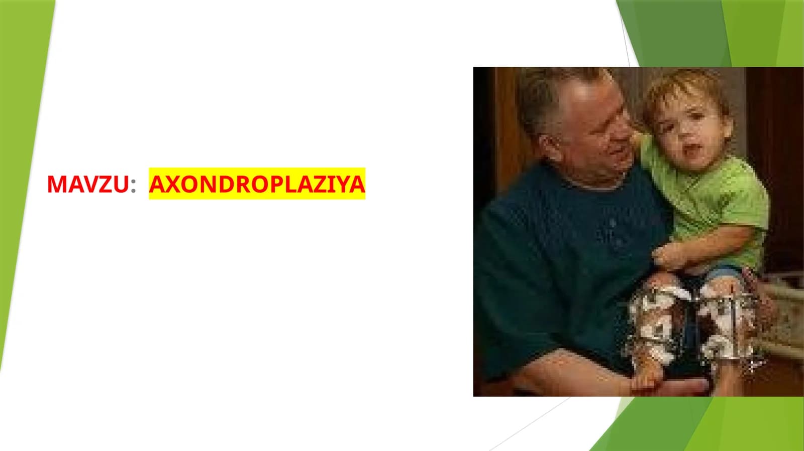 AXONDROPLAZIYA