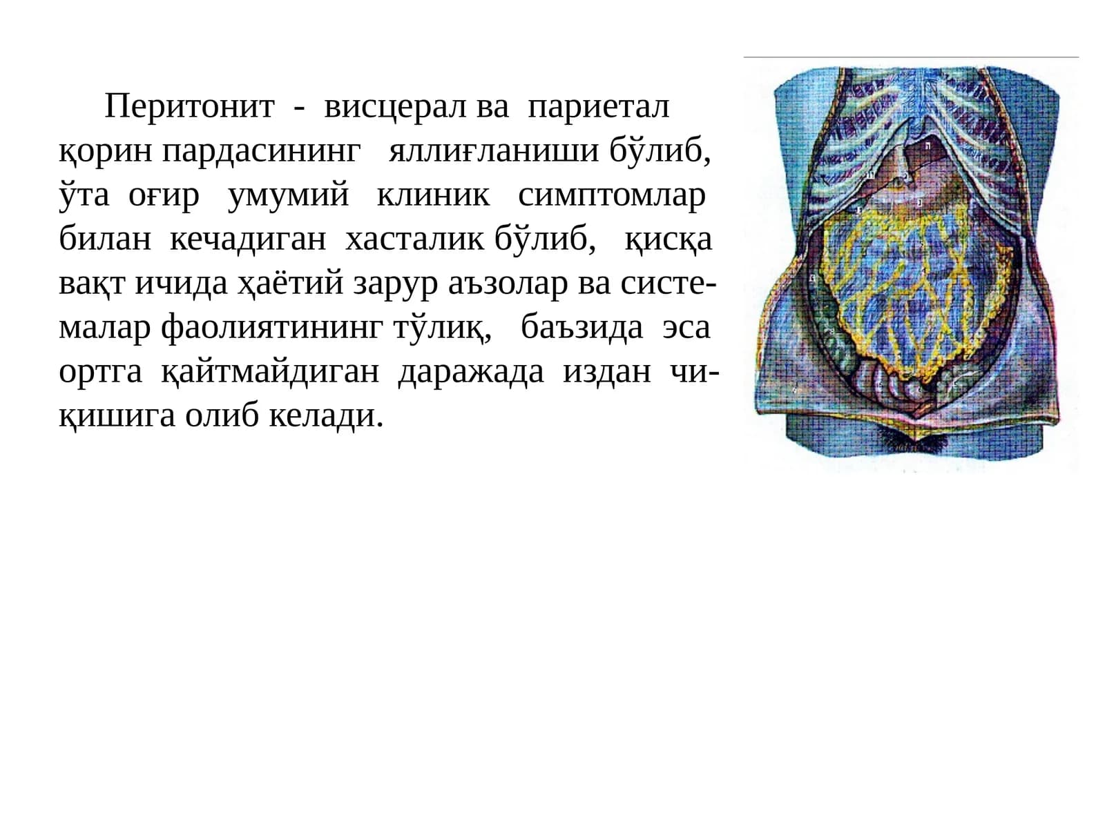 Перитонит-висцералвапариеталқорин пардасининг яллиғланиши
