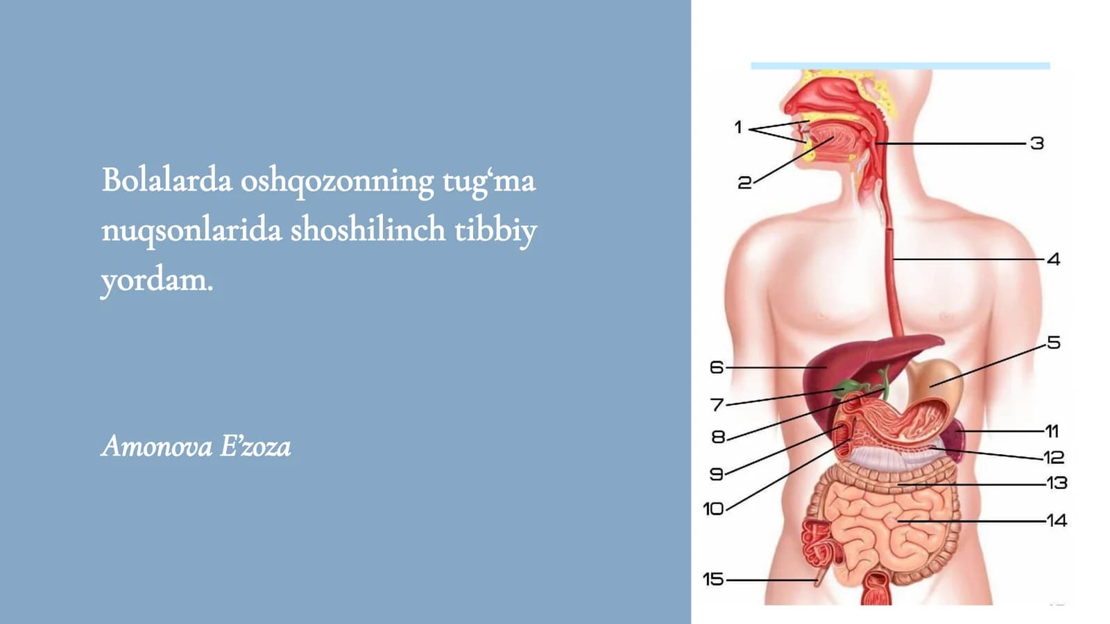 Bolalarda oshqozonning tug‘ma nuqsonlarida shoshilinch tibbiy yordam