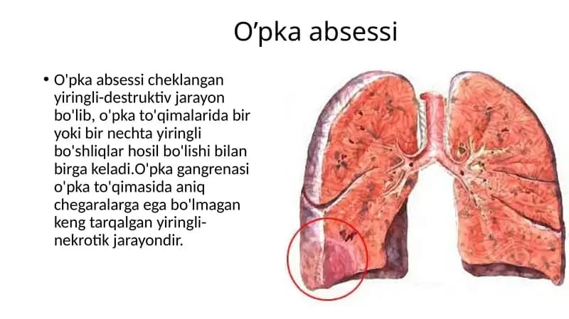 O’pka absessi patogenezi klinikasi va diagnostikasi