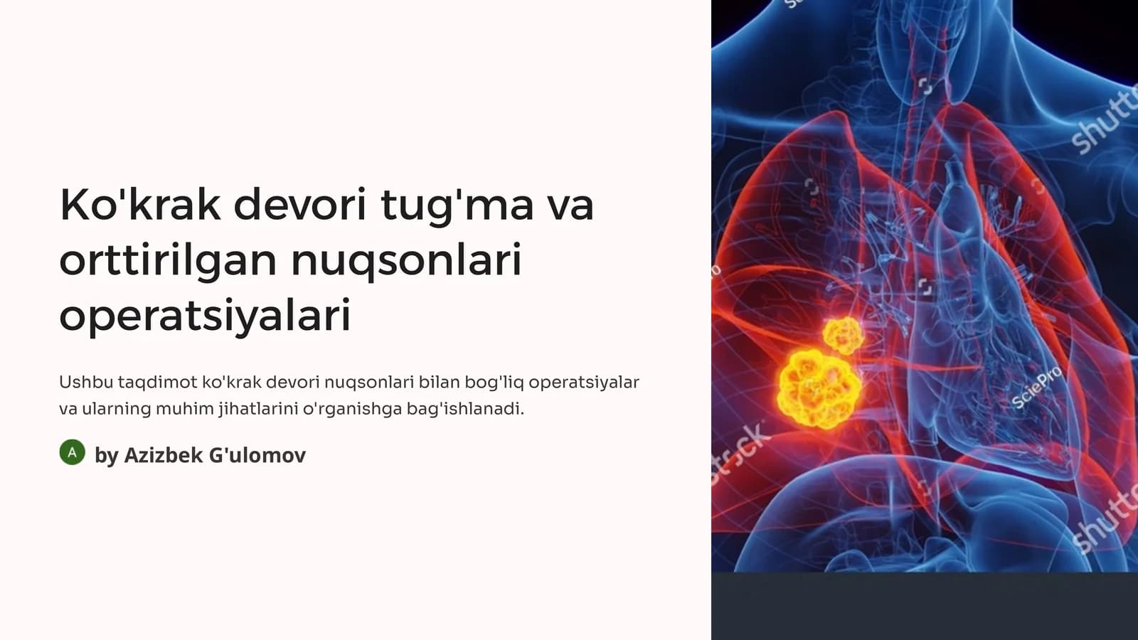 Ko'krak devori tug'ma va orttirilgan nuqsonlari operatsiyalari
