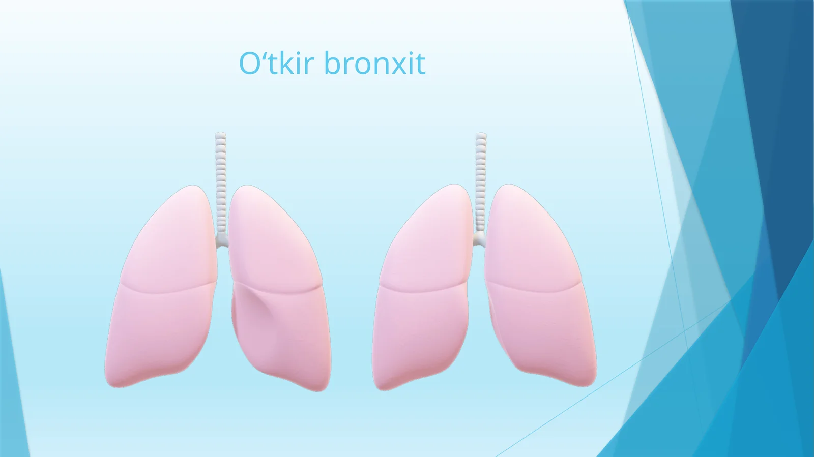 O‘tkirbronxit