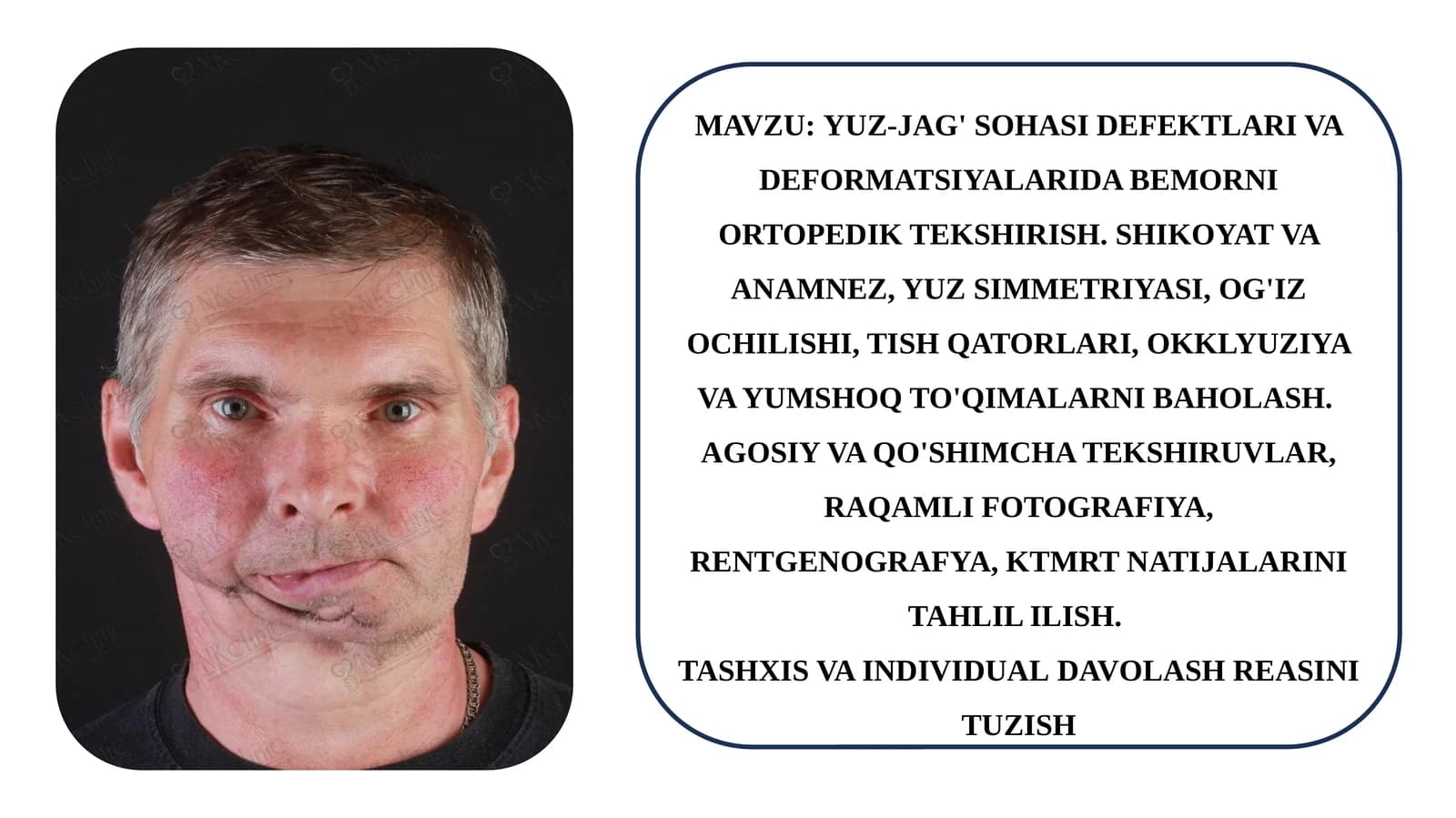 YUZ-JAG' SOHASI DEFEKTLARI VA DEFORMATSIYALARIDA BEMORNI ORTOPEDIK TEKSHIRISH