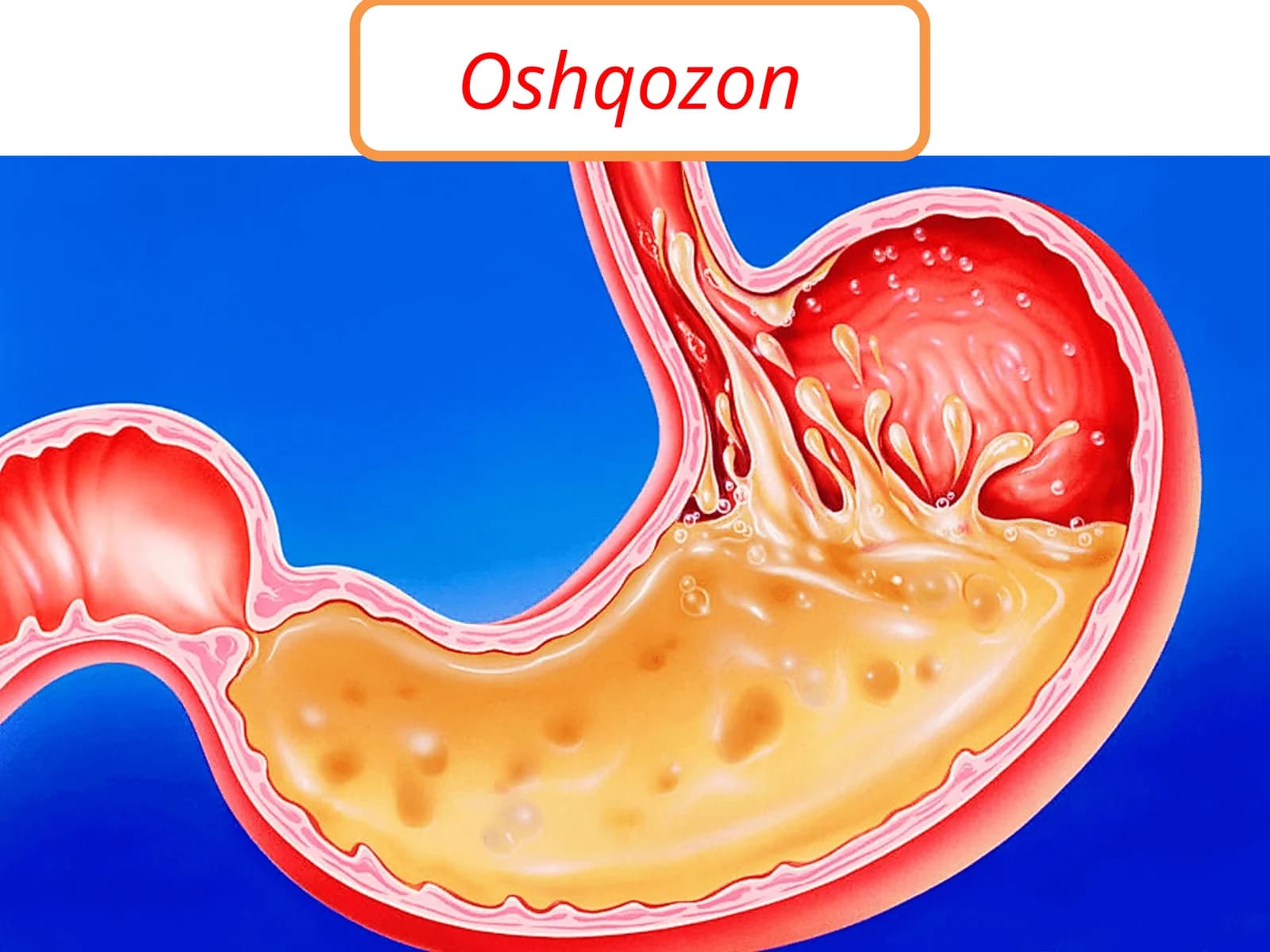 Oshqozon