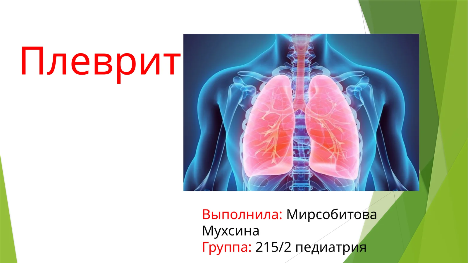 Плеврит