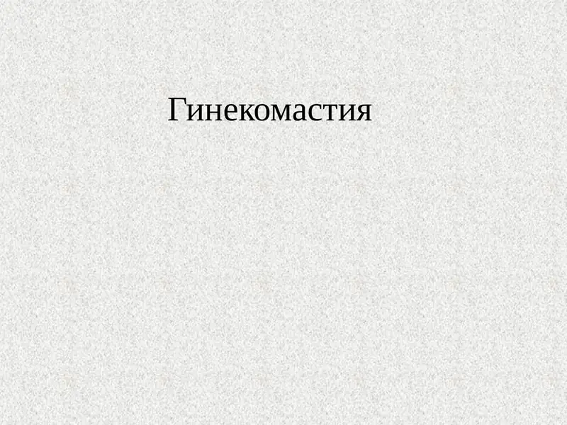 Гинекомастия