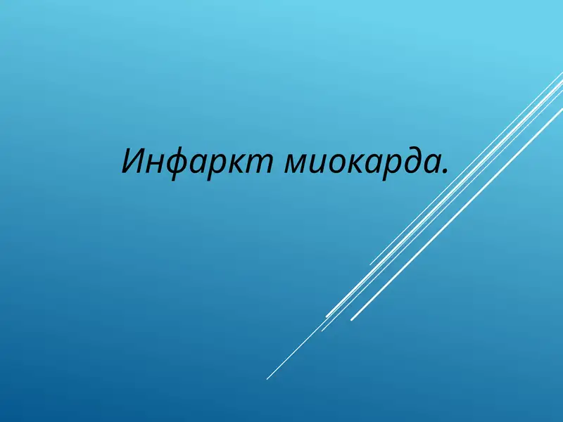Инфаркт миокарда