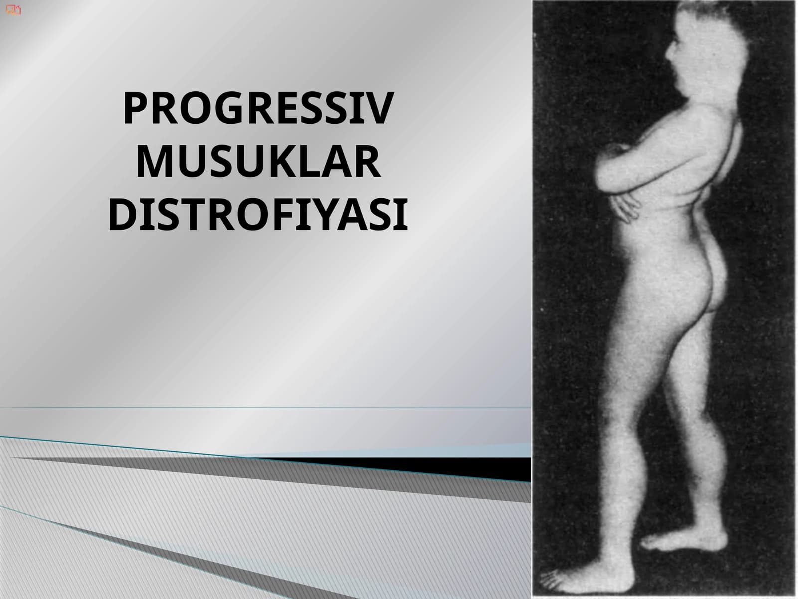 Progressiv Mushaklar Distrofiyasi