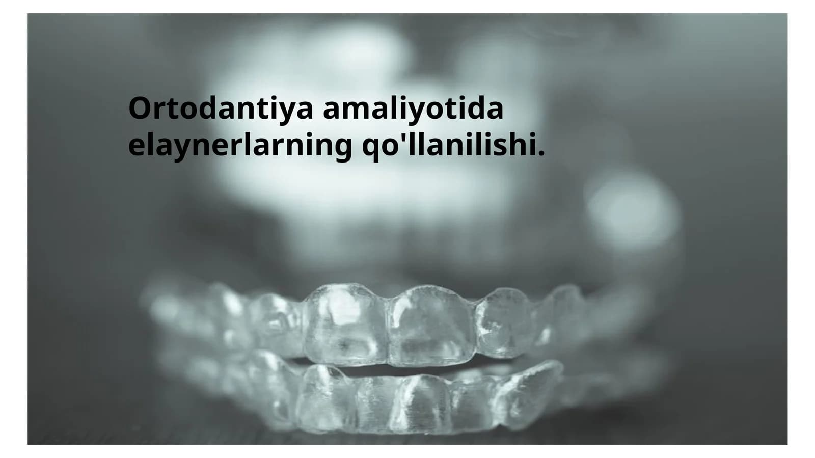 Elaynerlar