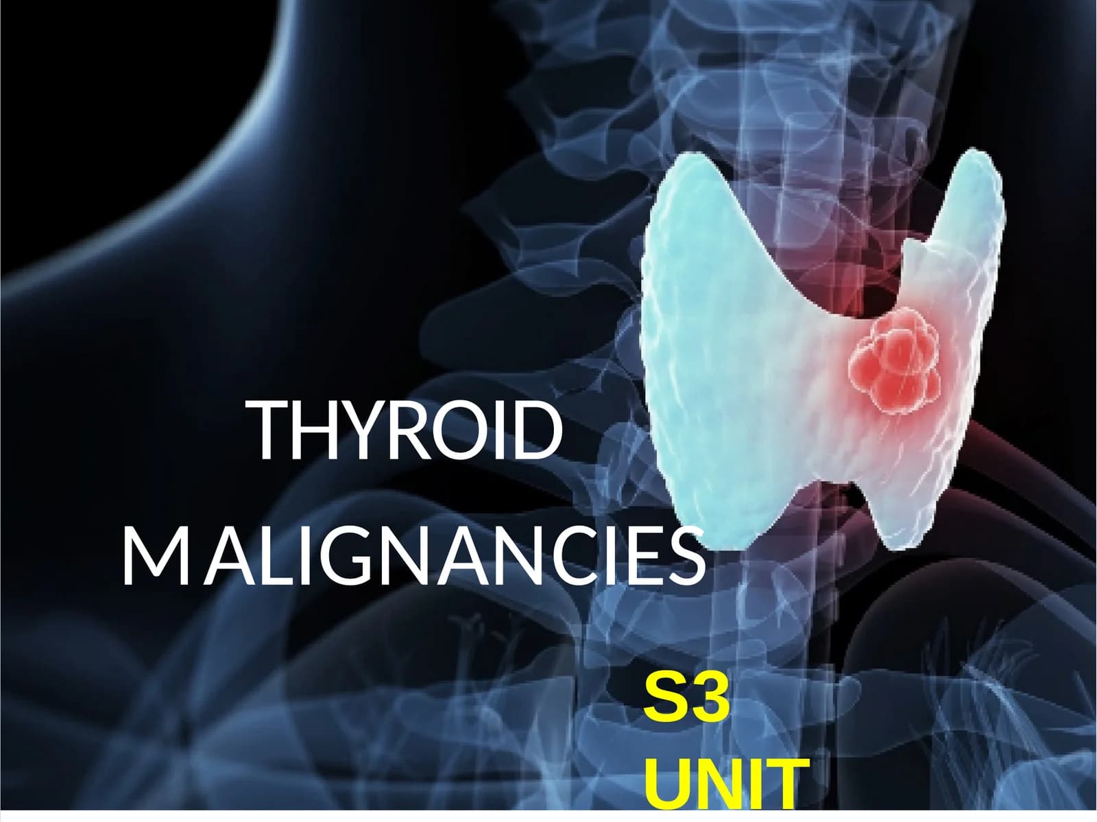 THYROIDMALIGNANCIES