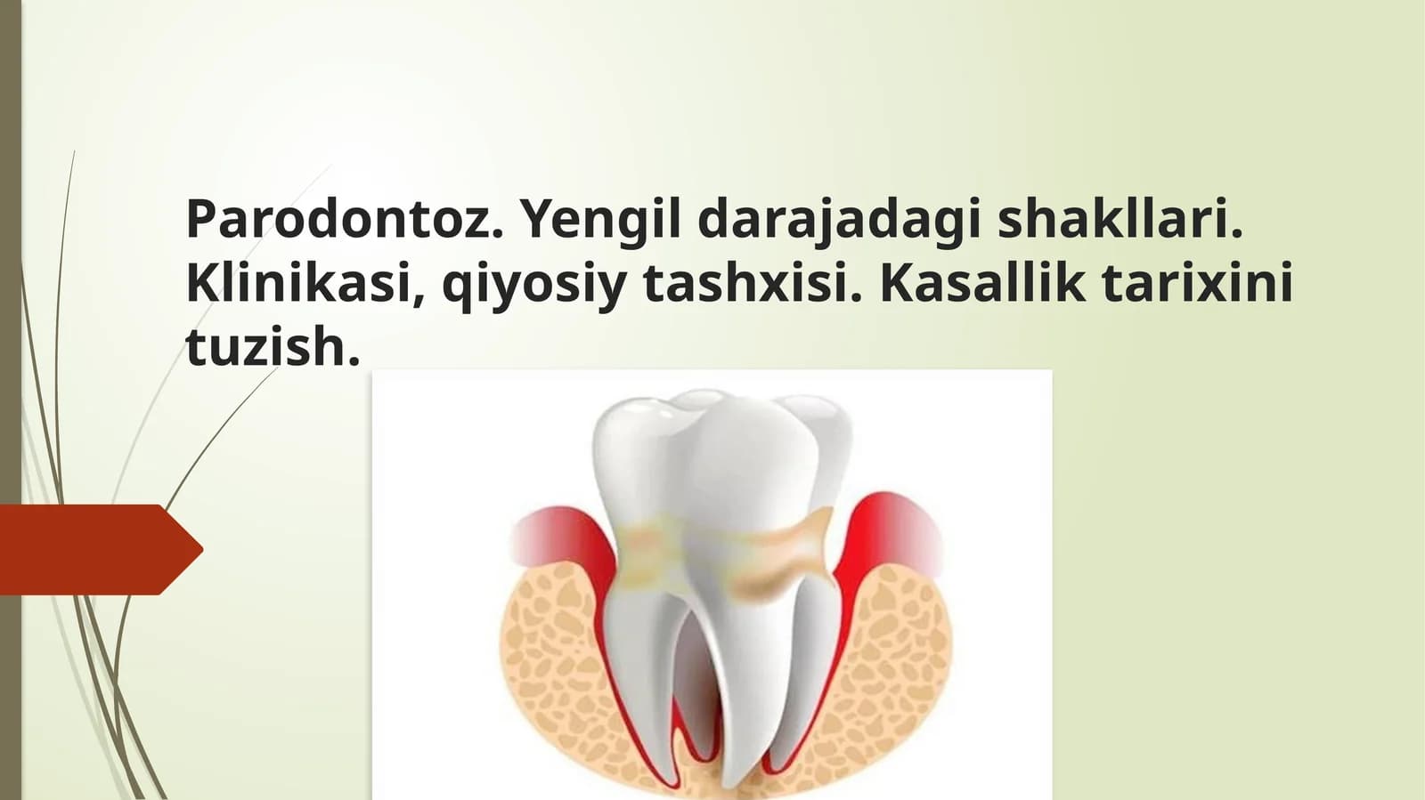 Parodontoz. Yengil darajadagi shakllari. Klinikasi, qiyosiy tashxisi. Kasallik tarixini tuzish