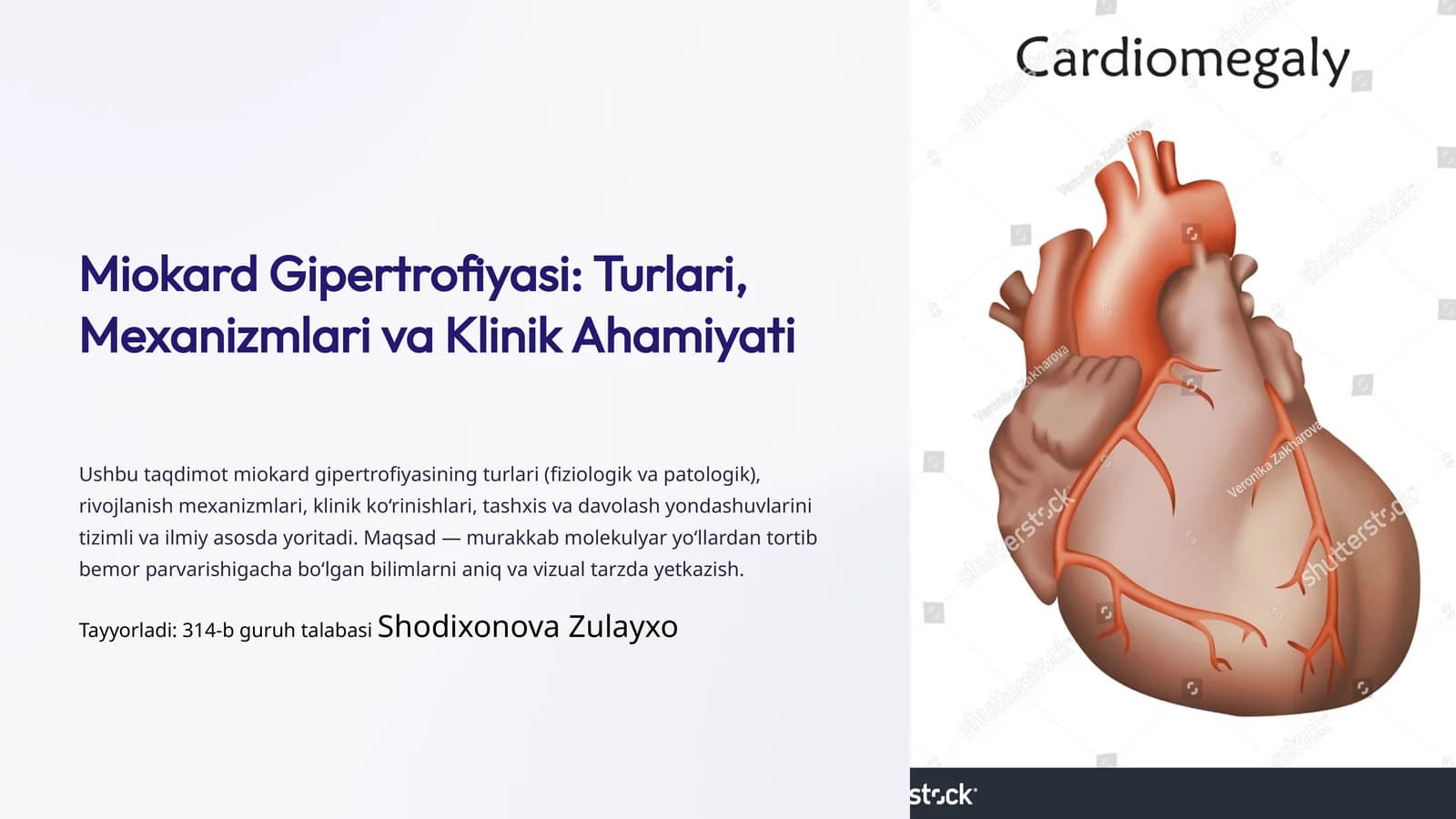 Miokard Gipertrofiyasi: Turlari, Mexanizmlari va Klinik Ahamiyati