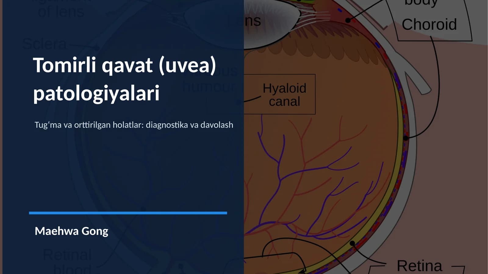 Tomirli qavat (uvea)