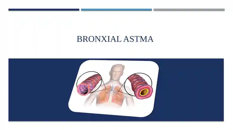 BRONXIAL ASTMA