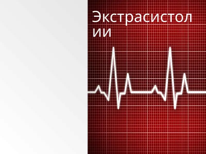 Экстрасистолии