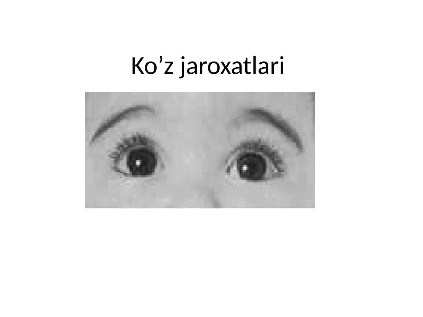 Ko’zjaroxatlari