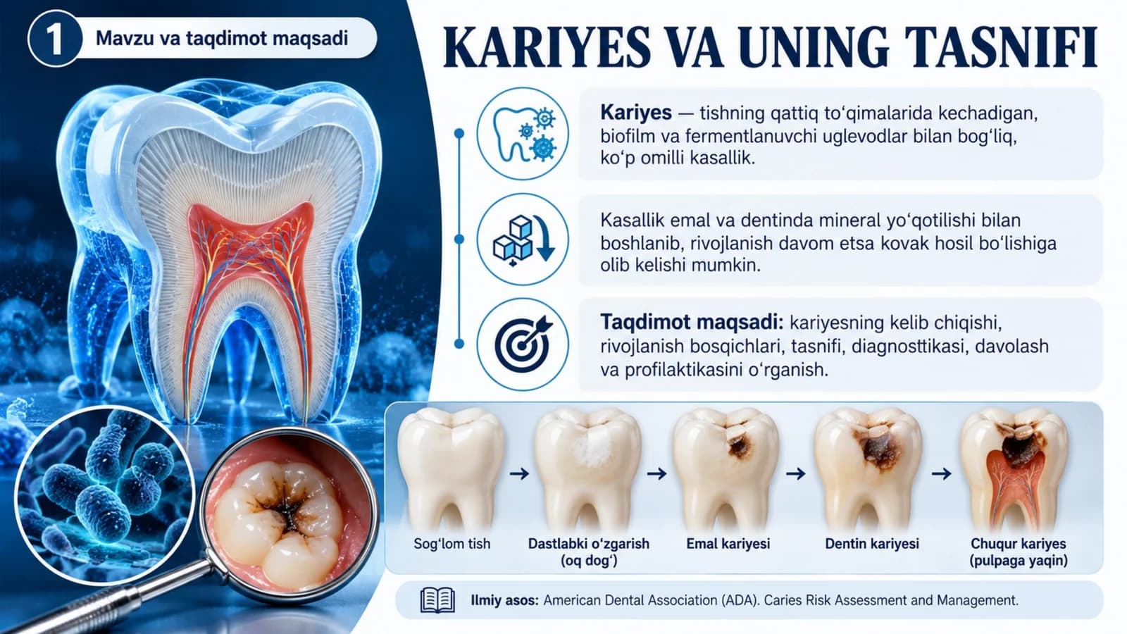 Kariyes va uning tasnifi — Professional tibbiy taqdimot