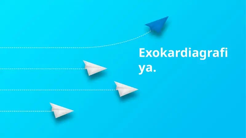 Ekokardiyografiya