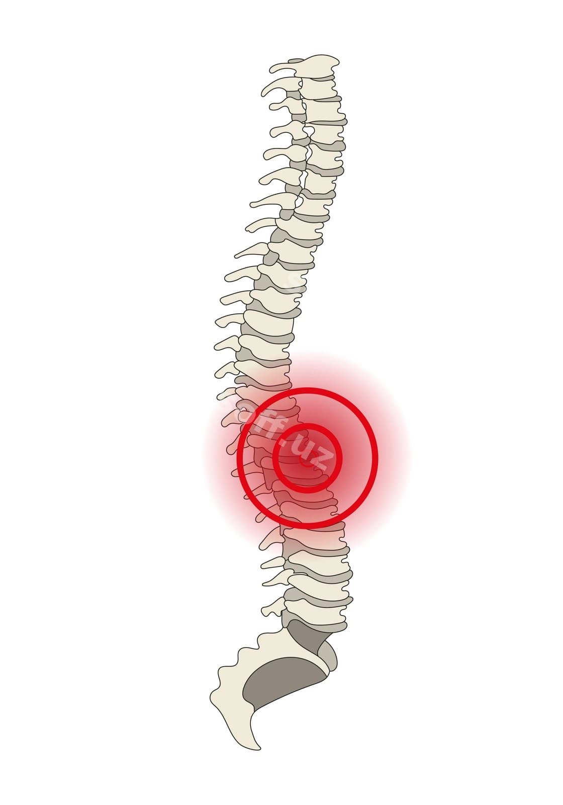 Orqa miya og'rig'i vektori | Spine pain back vector